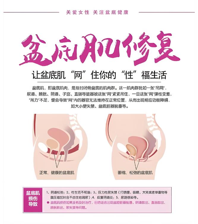 怎么治疗盆底肌障碍